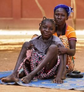 Adelphe, before the operation, with her mom